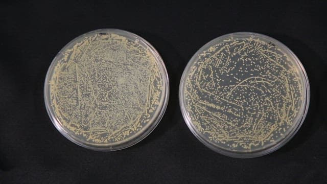 Petri dish for observing Staphylococcus aureus