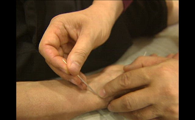 Doctor Treating a Patient with Acupuncture in Oriental Medical Clinic