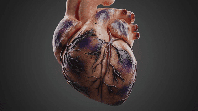 Human heart model turning purple and diseased