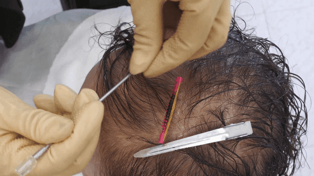 Hairdresser who gives perms to women with hair loss