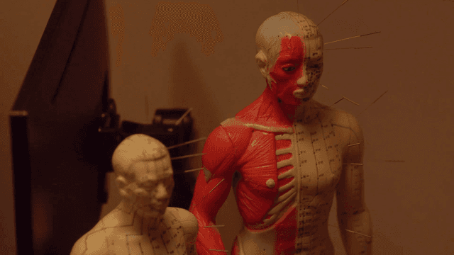 침이 꽂힌 침술 모형