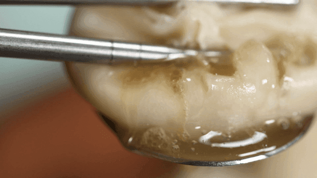 Juicy dumplings