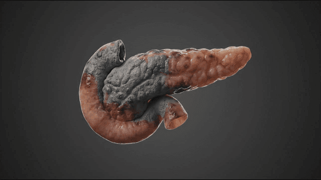 Detailed view of rotting pancreas