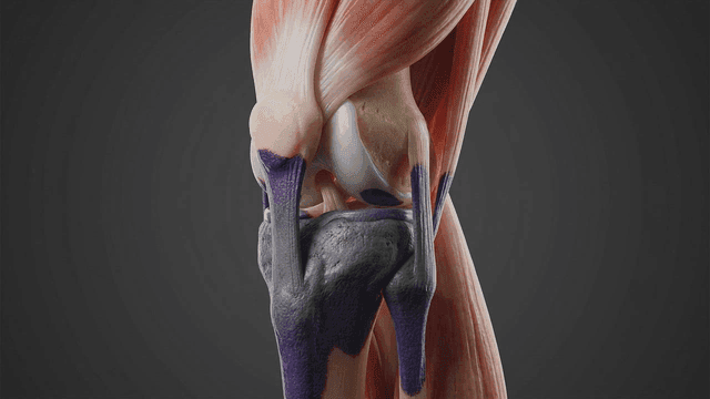 Detailed view of diseased human knee joint