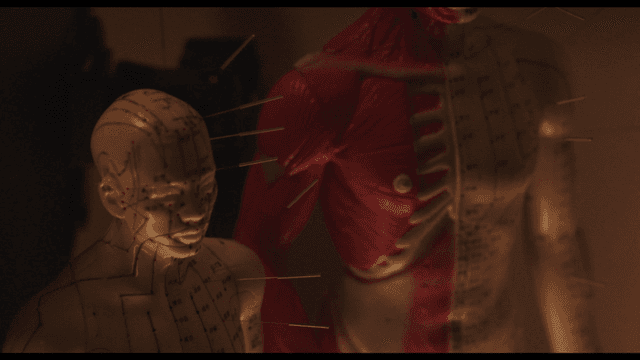 침이 꽂힌 침술 모형