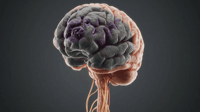 Detailed view of infected brain model