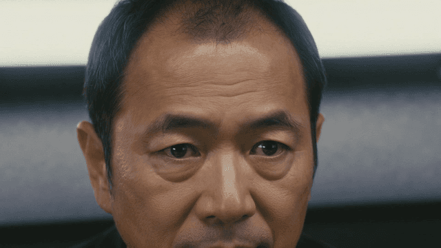 Close-up of middle-aged man's hair loss area