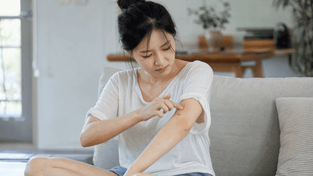 Woman scratching her arm