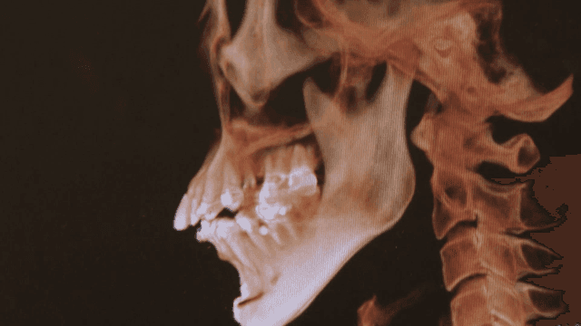 인간 두개골과 척추의 상세한 엑스레이