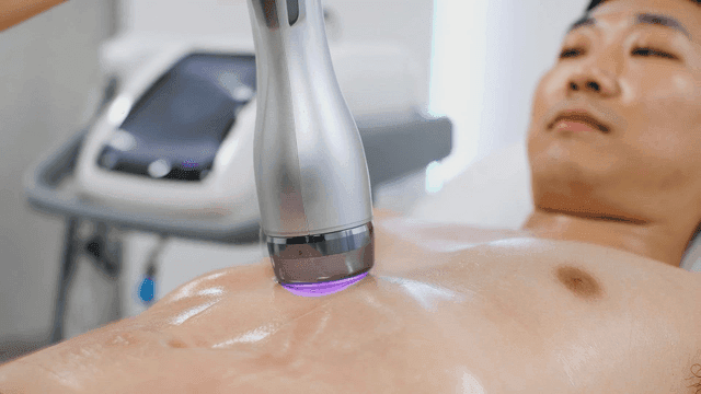 Medical device for cosmetic treatment on men's chests