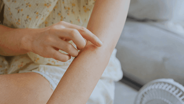 Woman scratching her arm
