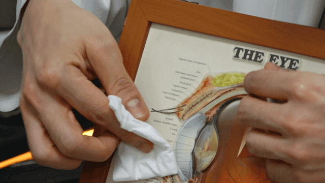 눈 해부도 차트를 들고 각막을 닦는 방법을 설명하는 의사