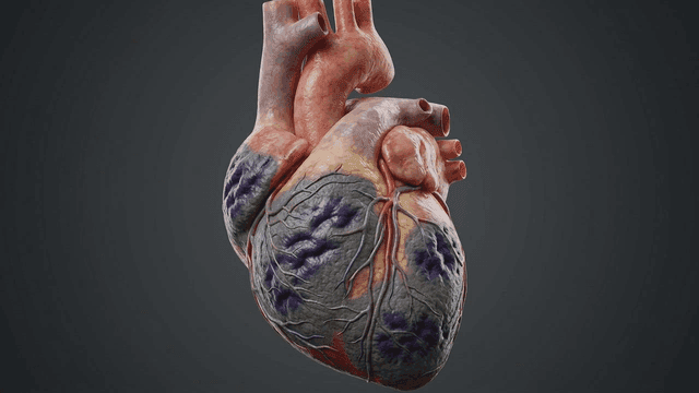 Detailed view of infected human heart model