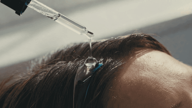 Woman applying serum to her scalp