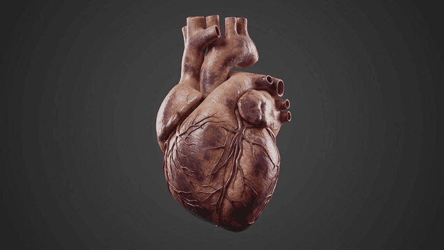 Detailed view of model of diseased human heart