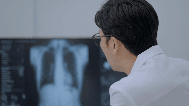 의사가 흉부 X-ray 이미지를 검사하는 모습