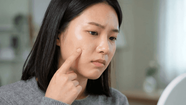 Woman examining skin troubles