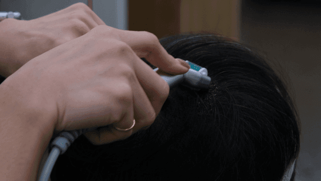 Scalp treatment with a specialized device