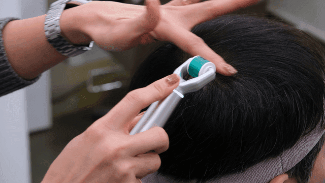Scalp care using roller device