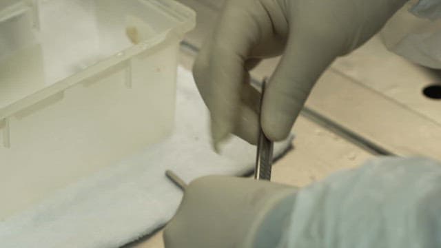 수술용 메스를 들고 있는 장갑 낀 손