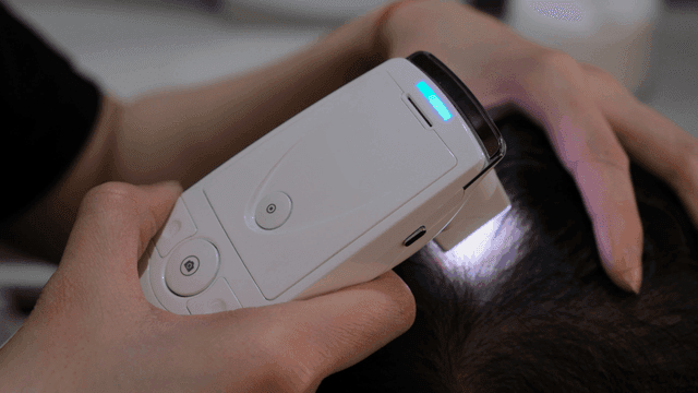 Hair examination with a scalp device