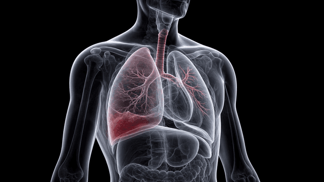 X-ray image with lung emphasis