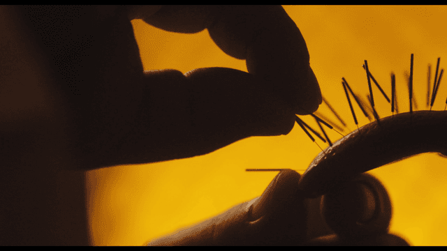 혀에 진행 중인 침술