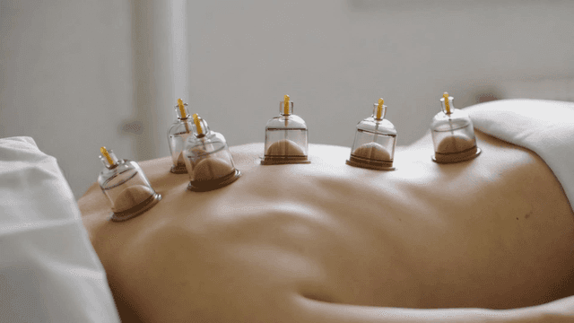 Cupping therapy on a person's back