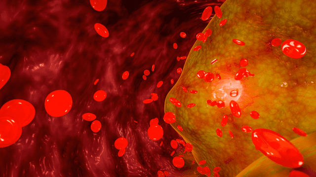 Red blood cells flowing through blocked blood vessels