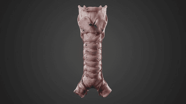 Detailed view of model of diseased human organ
