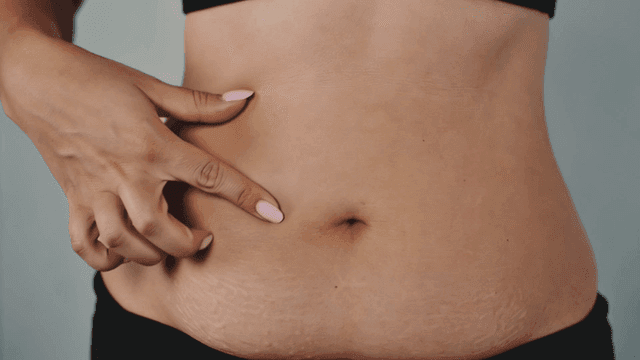 Woman picking at belly skin