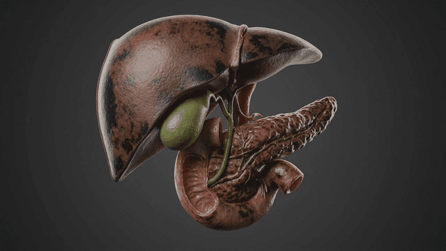 Detailed view of diseased human liver and pancreas