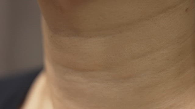 목의 주름 클로즈업