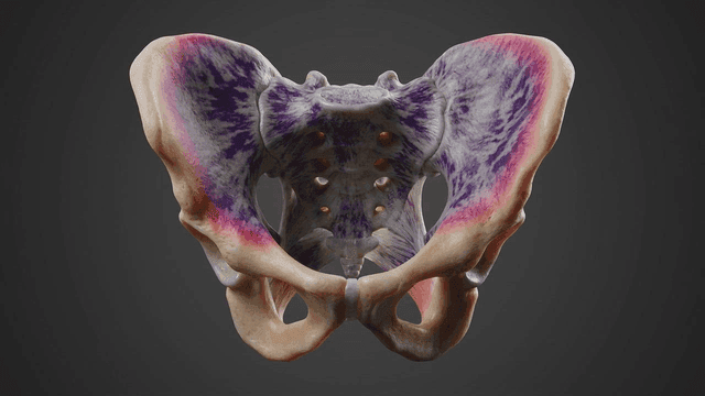 Detailed view of model of diseased human pelvis