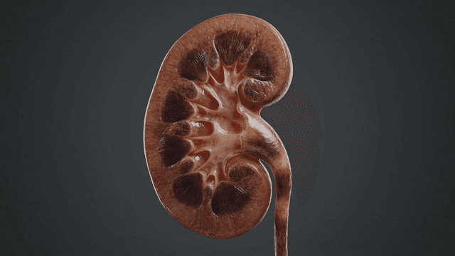 Detailed view of diseased human kidney