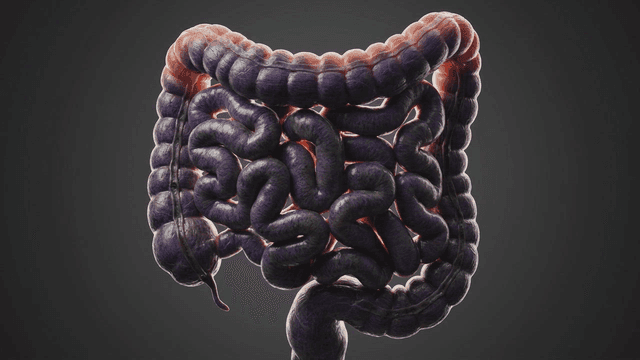 Detailed view of diseased human digestive organs