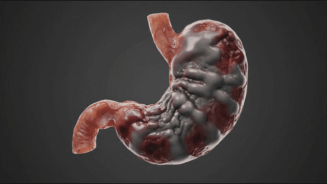 Rotting stomach