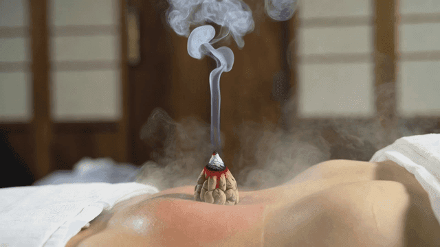 People receiving traditional moxibustion treatment