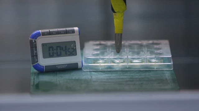 Timer and pipette in a laboratory setting