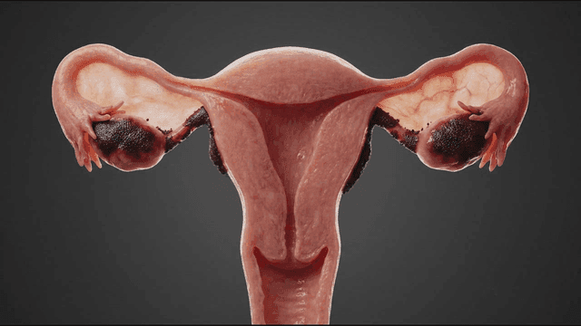 Detailed view of female reproductive organs where virus spreads