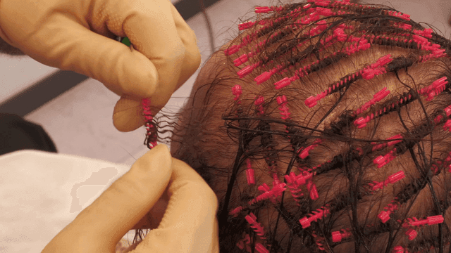 Hairdresser styling balding woman's hair in pink.