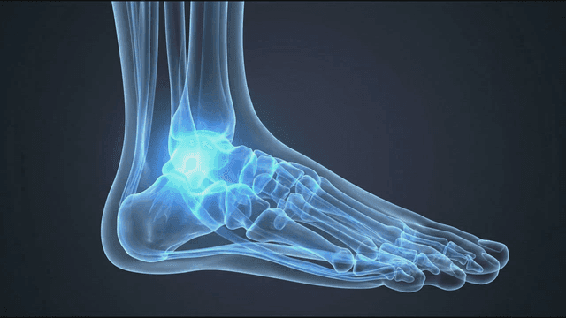 X-ray model of human foot