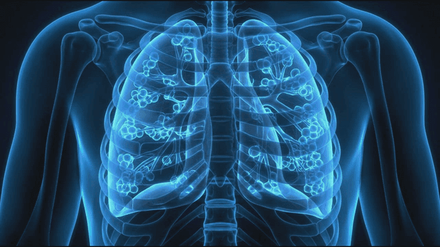 X-ray of breathing lungs