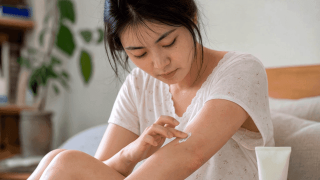 Young woman applying ointment to wound on her arm
