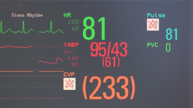 Hospital monitor showing vital signs, heart rate, and blood pressure readings