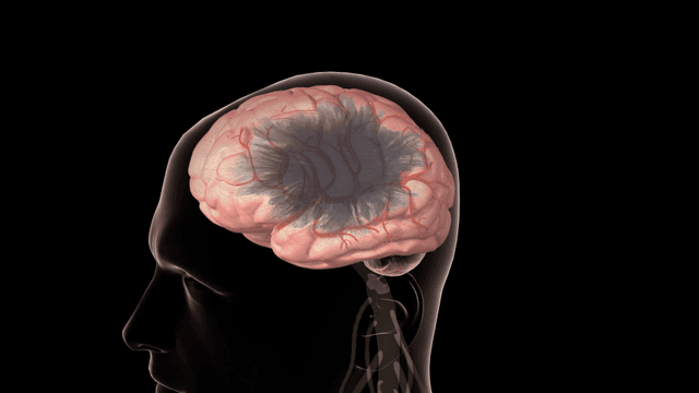 Toxic substances spread throughout human brain anatomy