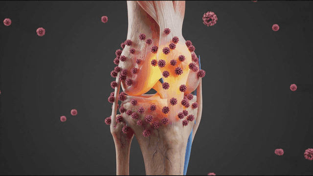 Anatomical view of a knee joint with inflammation