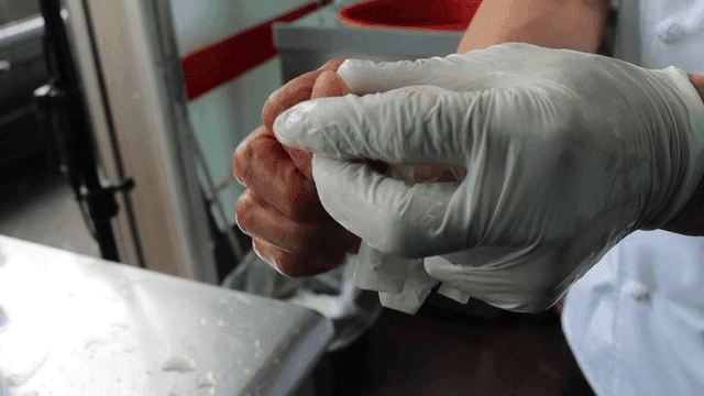 손에 흉터를 보여주는 사람