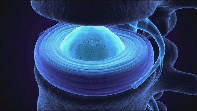 3D model showing structure of discs between vertebrae