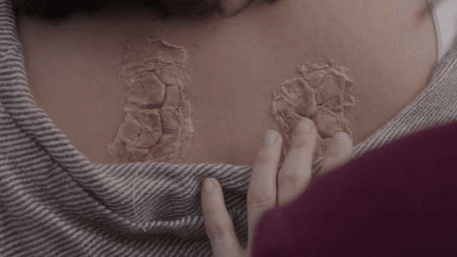 등에 상처를 입은 여성